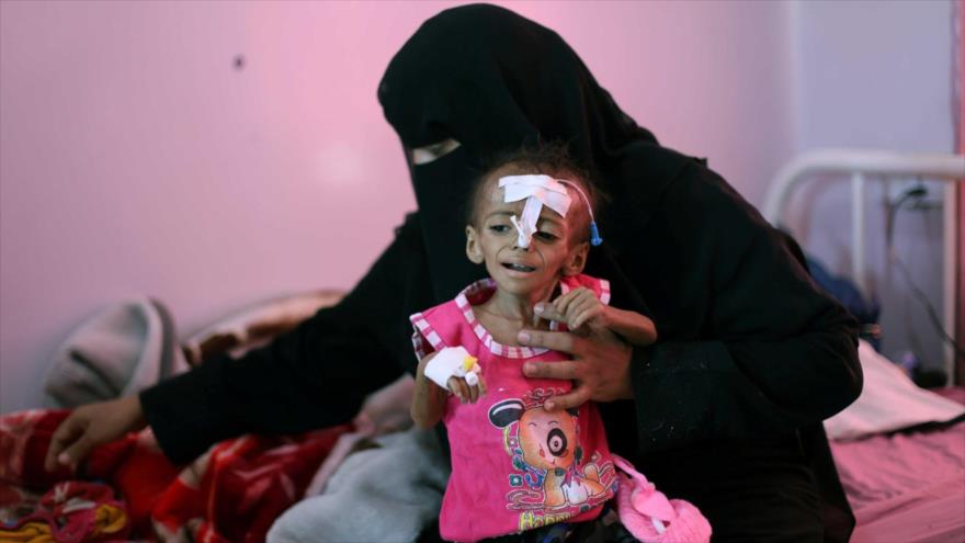 Una mujer sostiene a su hija desnutrida en un hospital en Saná, capital de Yemen, 27 de octubre de 2020. (Foto: Reuters)