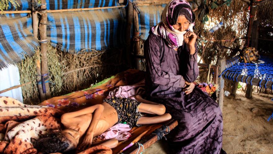 Una mujer yemení sentada junto a la cama de su hija, que sufre la desnutrición aguda, 23 de enero de 2021. (Foto: AFP)