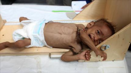 ONU alerta: Cinco millones de yemeníes al borde de la hambruna