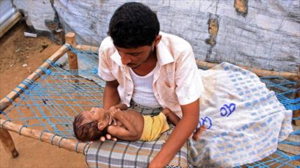 ONU: El hambre atacó a 155 millones de personas en 2020