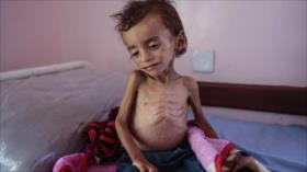 ‘Llegada de alimentos es derecho incondicional de yemeníes’