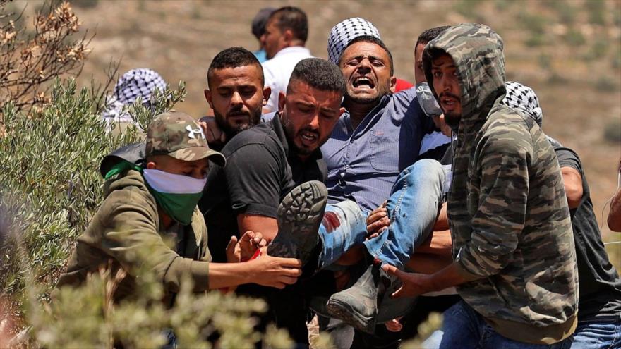 Un palestino herido por disparos de balas de goma de los soldados israelíes.