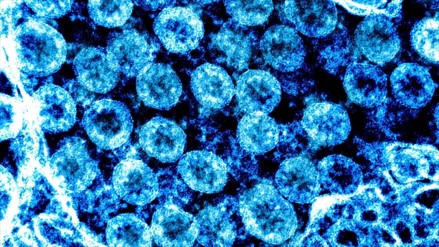 Descubren un método para bloquear la infección del nuevo coronavirus | HISPANTV
