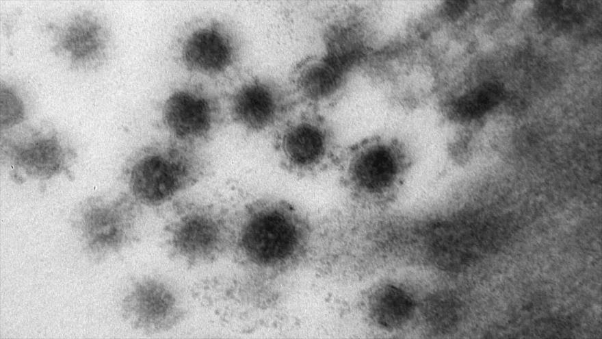 Cepa Delta del coronavirus. (Foto: Véktor) 