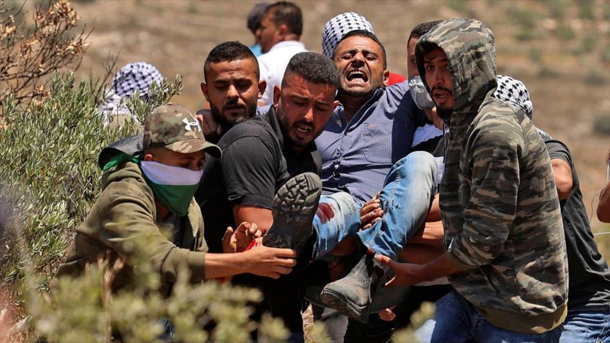 Manifestantes palestinos llevan a un herido en la aldea de Beita, al sur de Nablus (Cisjordania ocupada), 4 de junio de 2021. (Foto: AFP)
