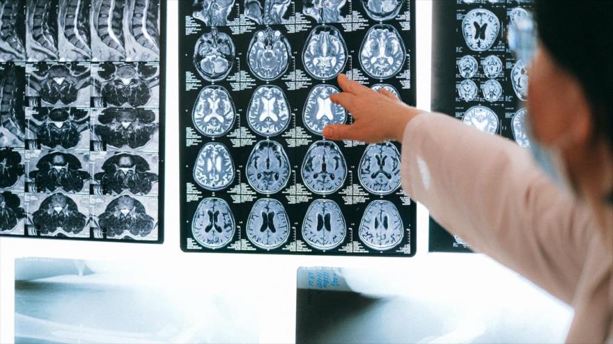 Un médico observando tomografías cerebrales.
