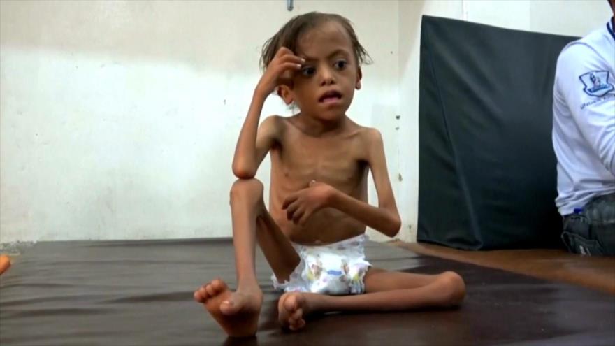 ONU reducirá raciones de alimentos para 8 millones de yemeníes