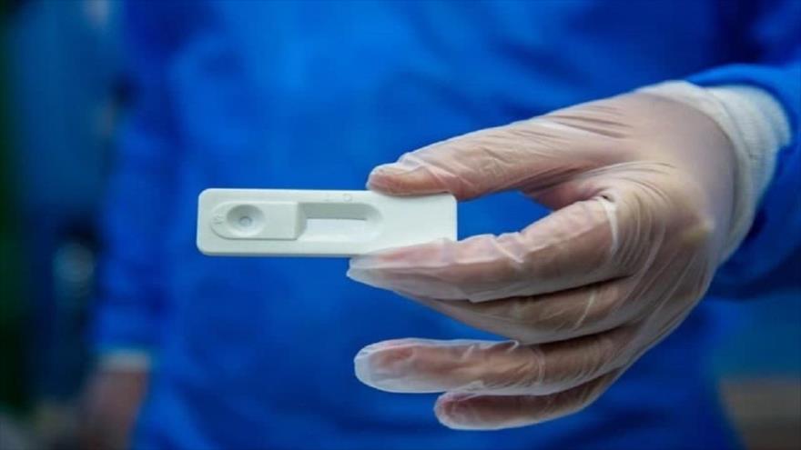El kit de pruebas desarrollado por científicos iraníes para detectar la nueva variante ómicron del coronavirus.
