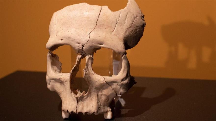 La parte frontal del cráneo de un guerrero de hace 2300 años encontrada en Barcelona.