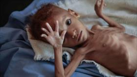 ONU avisa que millones de yemeníes sufren un aumento del hambre