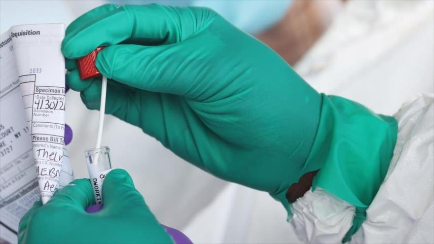Descubren posible nuevo tratamiento contra la COVID-19 | HISPANTV