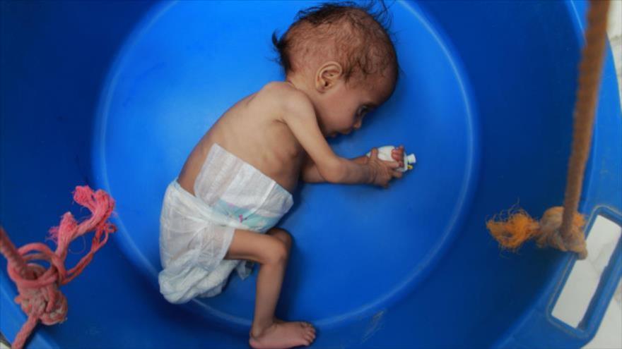 ONU alerta: Situación humanitaria de Yemen, al borde de “catástrofe”