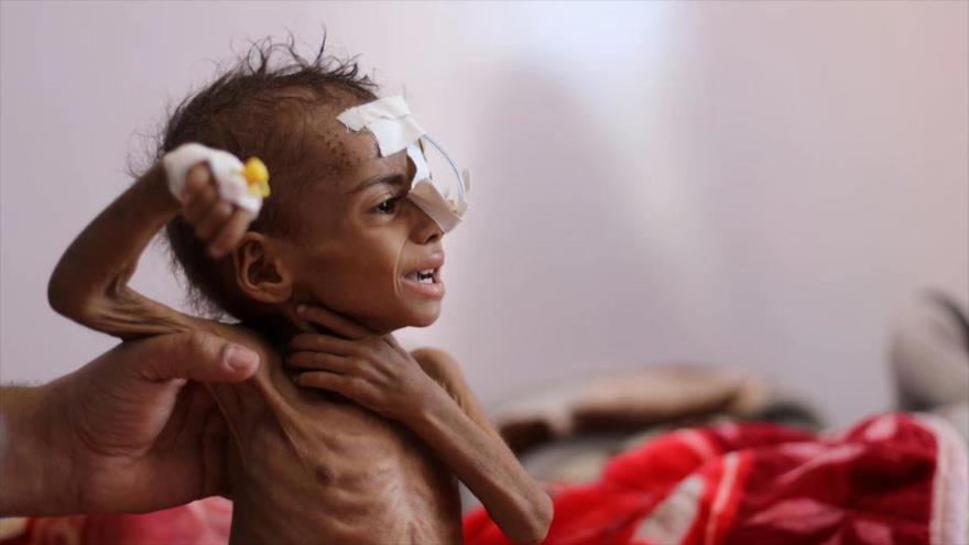 ¿Por qué no se atiende guerra y hambruna en Yemen? explica Alcaide