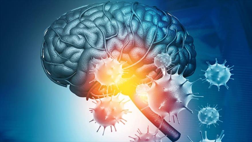 Reciente investigación revela cómo forma grave de coronavirus afecta al cerebro y podría envejecerlo hasta 20 años.