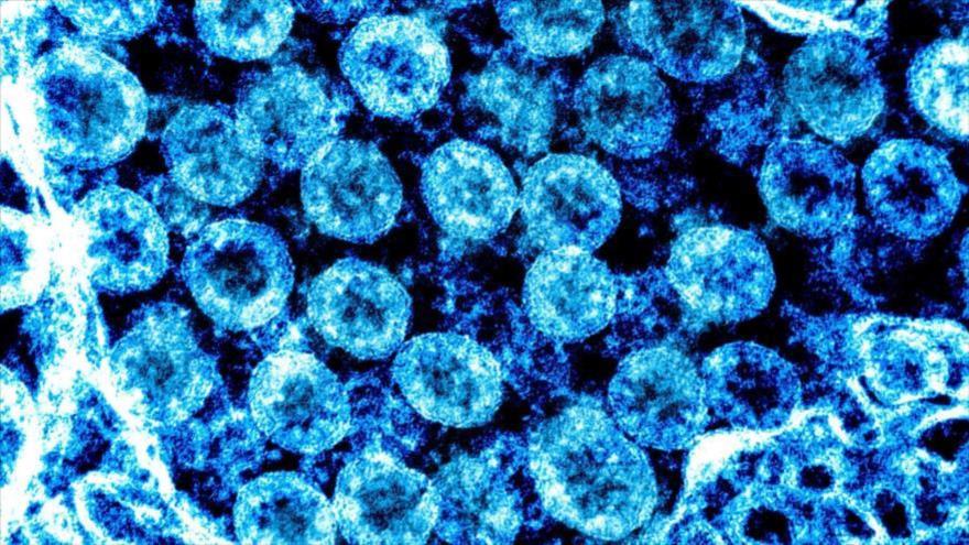 Micrografía electrónica de transmisión de los virus SARS-CoV-2, aislados de un paciente. (Foto: AFP)