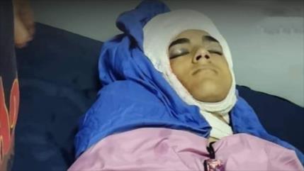 Represión israelí deja un adolescente palestino muerto y 75 heridos