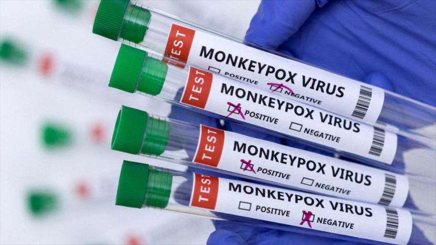 ¡Cuidado!: OMS detecta casos de reinfección con viruela del mono | HISPANTV