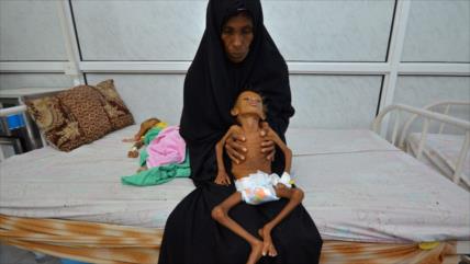 ONU alerta: Hambre alcanza el máximo nivel en Yemen desde 2015