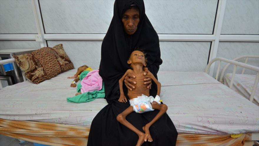ONU: Hambre alcanza el máximo nivel en Yemen desde inicio de agresión