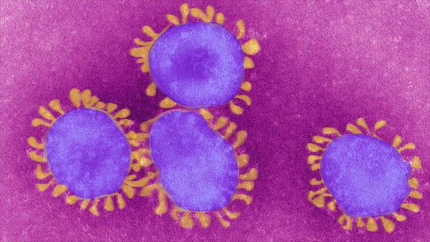 Coronavirus bajo el microscopio. (Foto: Getty Images)