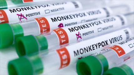 OMS declara emergencia global ante avance de viruela de mono