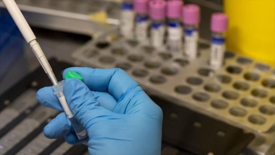 Un técnico de laboratorio médico inactiva las muestras de viruela del mono, Madrid, 6 de junio de 2022. (Foto: Getty Images)