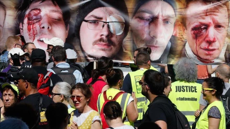 Los chalecos amarillos muestran imágenes de manifestantes heridos por la violencia policial durante las protestas en Francia.