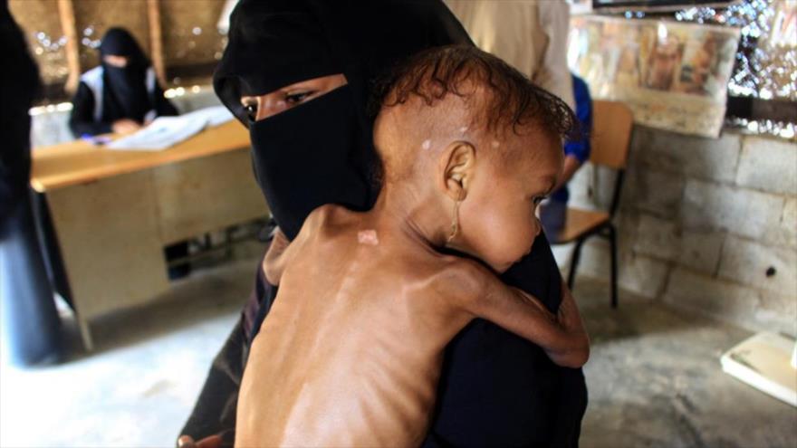 Una madre yemení lleva a su bebé que sufre de desnutrición severa, 22 de diciembre de 2021. (Foto: AFP)