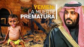 ¿Yemen sin futuro? | Detrás de la Razón