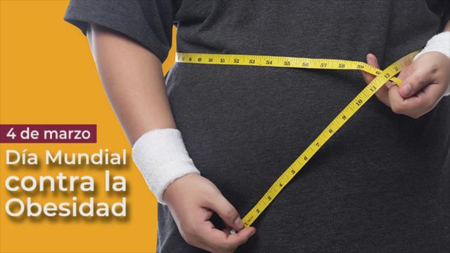 ¿Qué es la obesidad? la acumulación anormal y excesiva de grasa, que daña nuestra salud y calidad de vida