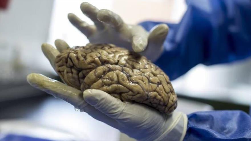 Uno de los cerebros donados para el estudio de la mutación E280A —que provoca la demencia temprana— en la Universidad de Antioquia, en Medellín (Colombia).