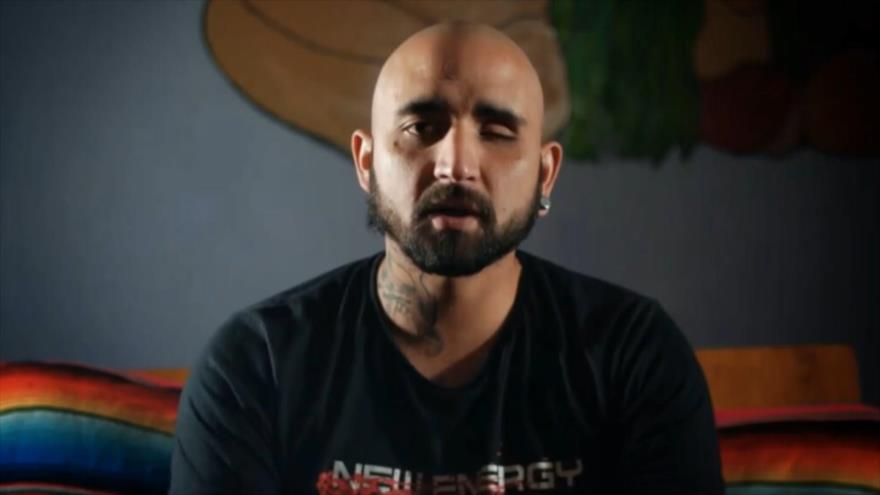 Víctimas chilenas de trauma ocular critican haber sido abandonadas