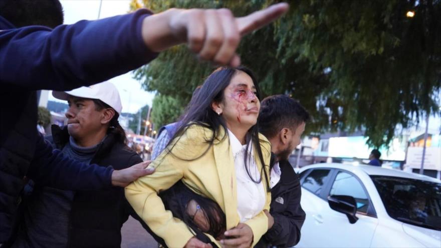 Una mujer ensangrentada tras el ataque que se cobró la vida del candidato Fernando Villavicencio en la capital ecuatoriana, 9 de agosto de 2023. (Foto: AP)