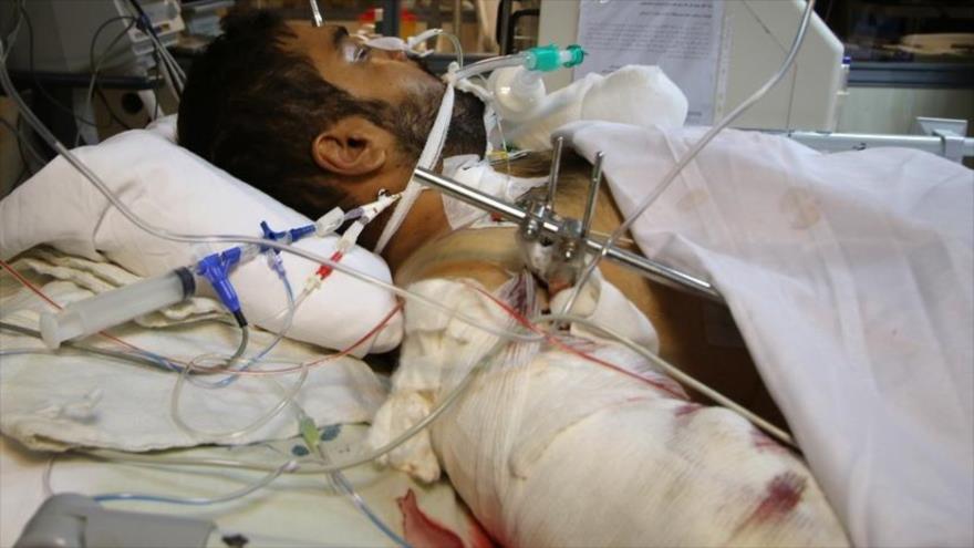 Un ciudadano iraní hospitalizado en la ciudad de Shiraz tras resultar herido en el ataque terrorista en Shah Cheraq, 14 de agosto de 2022. (Foto: Fars)