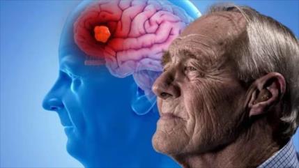 ¿Puede el ayuno intermitente aliviar a personas con Alzheimer?