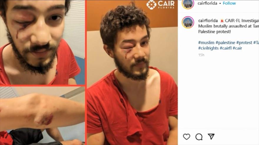 Antisociales sionistas atacan marchas pacíficas por Palestina en EEUU