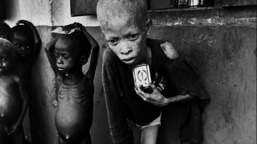 Guerra entre Nigeria y Biafra|Fotos que sacuden al mundo