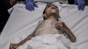2 niños palestinos mueren de hambre tras asedio israelí a Gaza