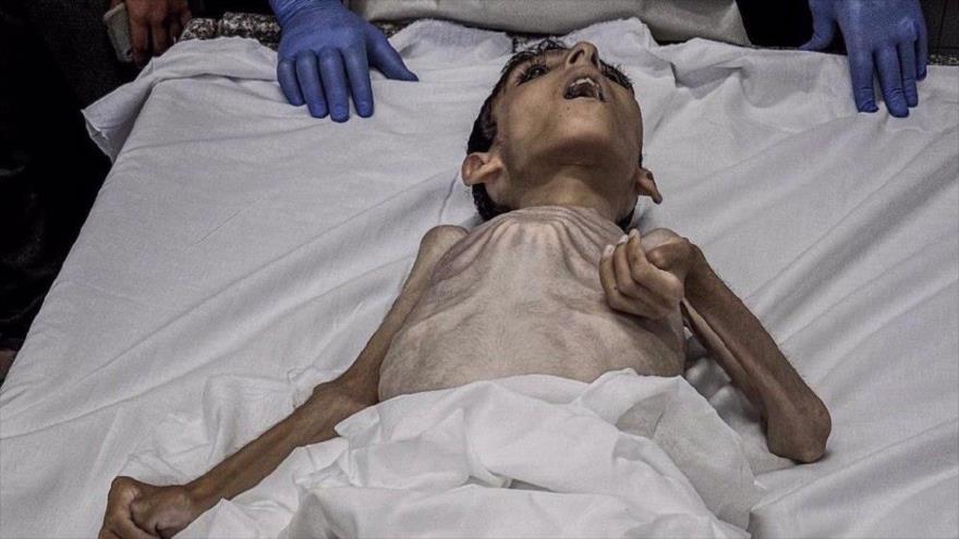 Abdul Qader al-Sarhi, adolescente palestino, muere de hambre en la zona central de la Franja de Gaza el 1 de junio de 2024. 