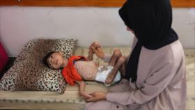 Unicef: 3000 niños en riesgo de muerte durante invasión israelí en Rafah