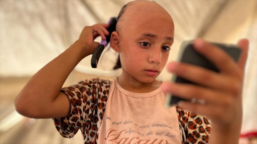 Niña pierde cabello por trauma causado por ataques israelíes en Gaza | HISPANTV