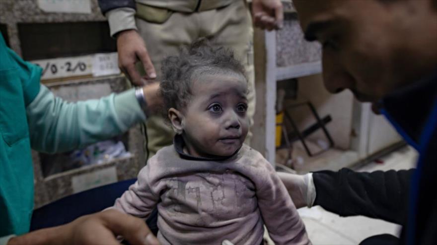 Un niño herido recibe atención médica en el hospital Nasser en Jan Yunis, en el sur de Gaza, tras un ataque israelí, 12 de enero de 2024. (Foto: EPA)