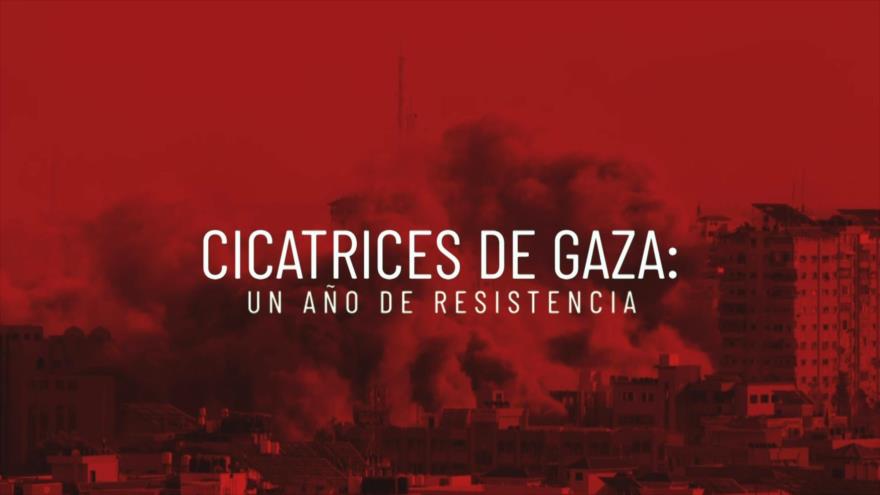 Cicatrices de Gaza: Un Año de Resistencia