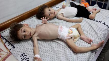 Unicef describe hospitales como “una zona de guerra” en Gaza