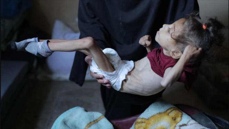 Una niña palestina lucha por sobrevivir debido a problemas de salud como resultado de la desnutrición, Deir al-Balah, Gaza, 18 de diciembre de 2024. (Foto: Getty Images)