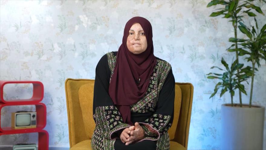 El día que mi coche se incendió - P1