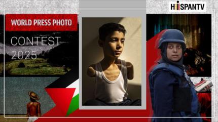 World Press Photo 2025: Un niño palestino de 9 años amputado simboliza la tragedia de Gaza