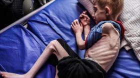 Informe: Israel mata a niños palestinos con armas o de hambre