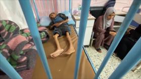 Crisis alimentaria en Gaza continúa deteriorando la vida de niños