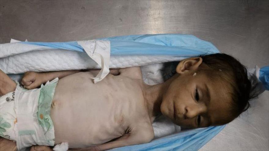 Yahya al-Najjar, un niño palestino de semanas de edad, que murió de hambre en el sur de la Franja de Gaza, 29 de julio de 2025.